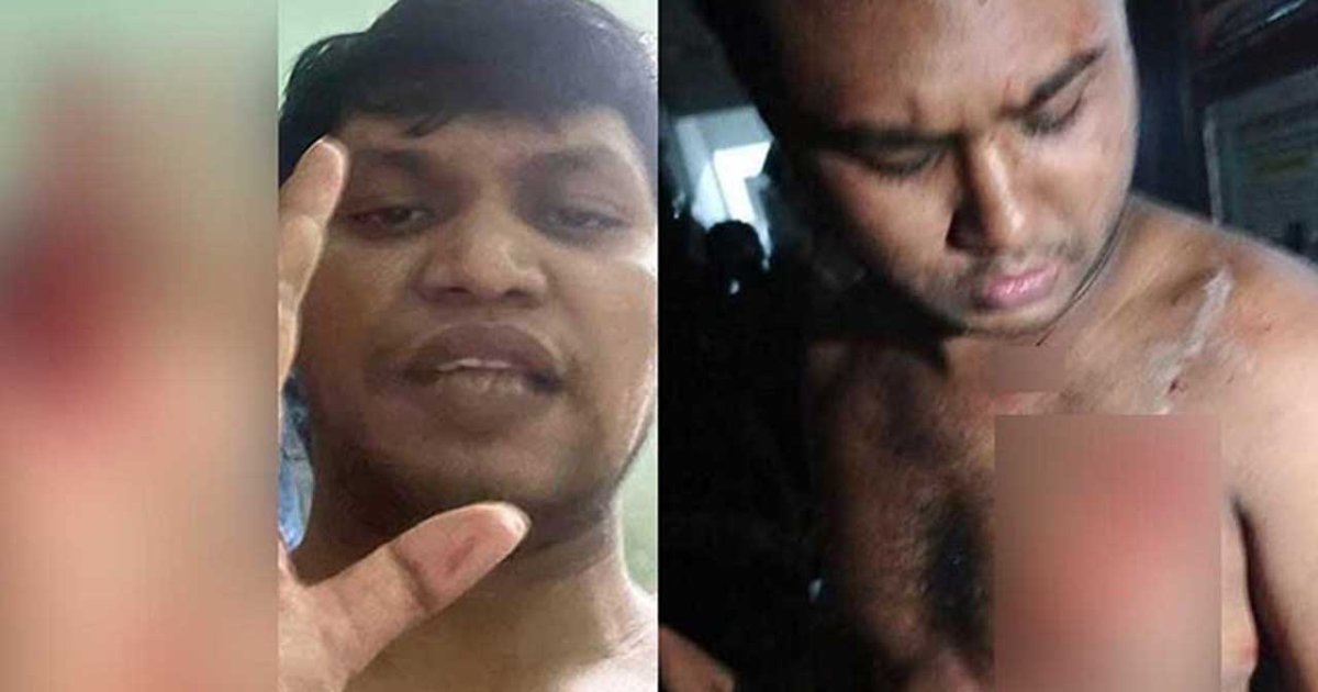 ঢাবিতে রুমমেটকে ছুরিকাঘাত : জ্বালাময়ী জালাল পুলিশের কাছে সোপর্দ