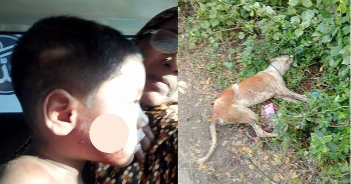 মুরাদনগরে পাগলা কুকুরের কামড়ে আহত অর্ধশতাধিক