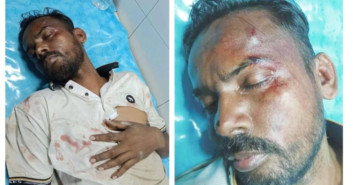 মেরে ফেলতেই হিরো আলমকে হামলা!