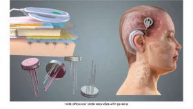 ব্রেন চিপের বিপদ-আপদ
