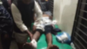 ইউপি চেয়ারম্যানের দুই পা থেঁতলে দিলো সন্ত্রাসীরা
