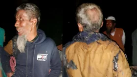 বগুড়ায় কৃষকের গায়ে আগুন দেওয়ার অভিযোগ