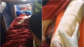 বিমানের বোয়িংয়ে ঝাঁকুনি, পা ভাঙল কেবিন ক্রুর