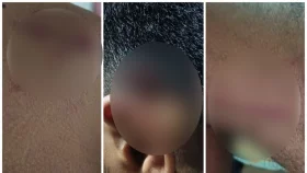 &lsquo;মনে হচ্ছিল আমিও আবরার ফাহাদের মতো মরে যাব&rsquo;