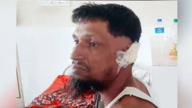 কামড় দিয়ে স্বামীর কান ছিঁড়ে নিলেন স্ত্রী