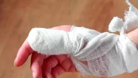 হাত-পা কেটে হাসপাতালে ছুটছেন &lsquo;মৌসুমি কসাইরা&rsquo;