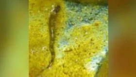 ডালে চুমুক দিতেই বেরিয়ে এলো সাপ, হাসপাতালে ১৫ শিক্ষার্থী