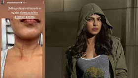 শুটিং করতে গিয়ে আহত প্রিয়াঙ্কা চোপড়া