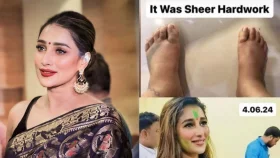 বীভৎসভাবে ফুলে গিয়েছে সায়ন্তিকার পা