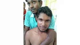 কামড় খেয়ে রাসেলস ভাইপার বস্তায় ভরে হাসপাতালে কৃষক