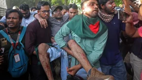 ঢাকার হাসপাতালগুলোতে গুলি-ছররা গুলিবিদ্ধদের চাপ&nbsp;