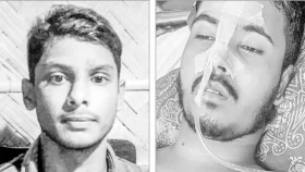 শরীরে বুলেট নিয়ে কাতরাচ্ছে কলেজ ছাত্র রিদোয়ান ও নবী হোসেন