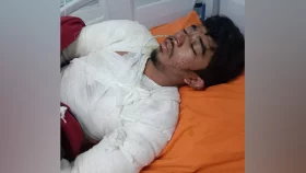 টানা ২৭ দিন মৃত্যুর সাথে পাঞ্জা লড়ে হেরে গেলেন অগ্নিদগ্ধ তেশাম