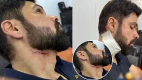 দুর্ঘটনার কবলে ইমরান হাশমি
