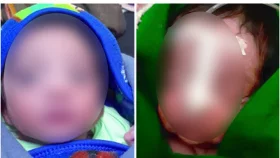 একমাসের শিশুকে বাঁচাতে সাংবাদিক বাবার আকুতি