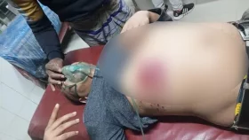 চাঁদাবাজির টাকা নিয়ে বিএনপির দুই পক্ষের সংঘর্ষ, যুবদল নেতা গুলিবিদ্ধ
