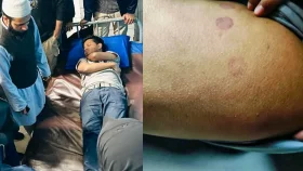 নারীসহ দুই জবি শিক্ষার্থীকে মেরে হাসপাতালে পাঠালো ছাত্রদল কর্মী