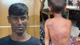 বাবার মারধরে মৃত্যুর সঙ্গে লড়ছে ৪ বছরের শিশু