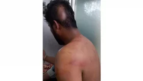 মুন্সীগঞ্জে মাদক কারবারিদের হামলায় ডিবির ৩ সদস্য আহত