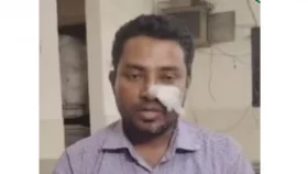 টাকা দিতে দেরি হওয়ায় ব্যাংক কর্মকর্তার ‘নাক’ ফাটালেন ছাত্রদল নেতা