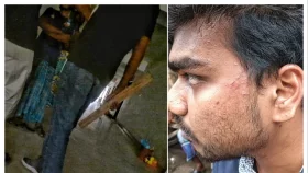 পূর্ব ঘটনার জেরে হামলায় কানের পর্দা ফেটেছে শিক্ষার্থীর