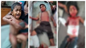 যশোরে ঘরের ভেতর বিস্ফোরণ, একই পরিবারের ৩ শিশু আহত