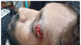 আখাউড়ায় সালিশ বৈঠকে মারামারি, আহত ৩