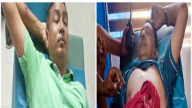 বগুড়ায় আসামির ছুরিকাঘাতে দুই পুলিশ সদস্য আহত