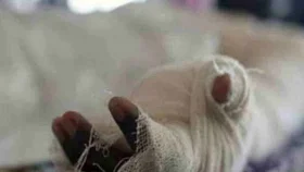 হাজারীবাগে পানির ট্যাংকি পরিস্কারের সময় বিস্ফোরণ, দগ্ধ ৪