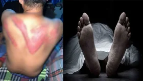 ছেলের গায়ে অপহরণকারীদের নির্যাতনের চিহ্ন দেখেই বাবার মৃত্যু