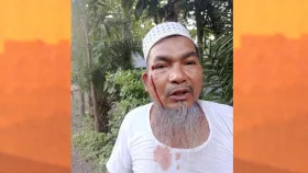 মসজিদ থেকে ছাগল তাড়ানোয় ইমামকে মারধর
