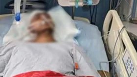 চারদিন ধরে লাইফ সাপোর্টে ইমতিয়াজ