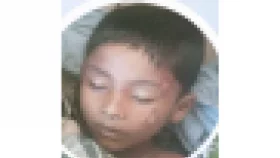 পুঁইছড়ি&zwnj;তে সড়ক দুর্ঘটনায় শিশুর মৃত্যু