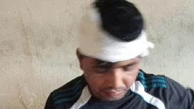 বোনের শ্বশুরবাড়ির লোকজনের হাতে আহত ছোট ভাই