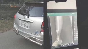রাবিতে শিক্ষকের গাড়ির ধাক্কায় পা ভাঙল ছাত্রীর