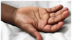 রাজধানীতে কাটা হাত-পা উদ্ধার