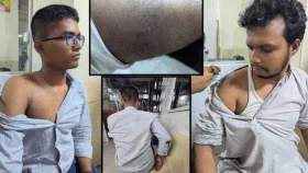 শাহবাগে শিবির-ছাত্রদলের সংঘর্ষে ১০ সাংবাদিক আহত