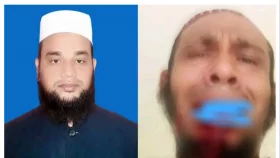 ঘুষি মেরে কম্পিউটার অপারেটরের দাঁত ভেঙে দিলেন অধ্যক্ষ
