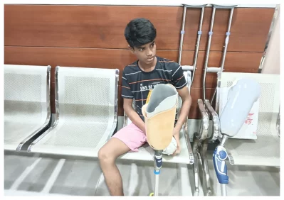 কৃত্রিম পা লাগানোর চেষ্টা করছেন এক তরুণ