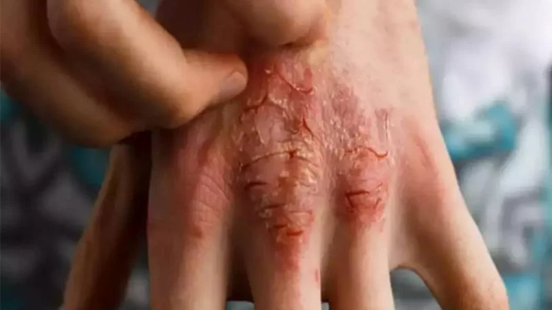 Dikni birinchi marta porno porno kordim Erkakning eshagidagi jinsiy olatni